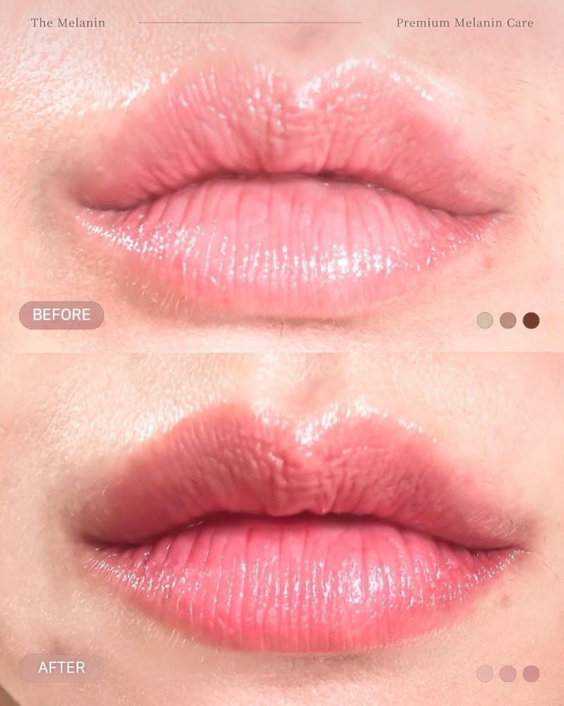 サウナ&エンビロンサロンととのいうさぎ~美肌・毛穴・シミケア・エンビロン・肌管理~