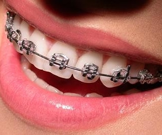 Dentista Cuiabá Dra Juliana - foto 4