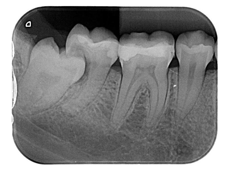 Clinocap Clinica Odontologica Capixaba - foto 4
