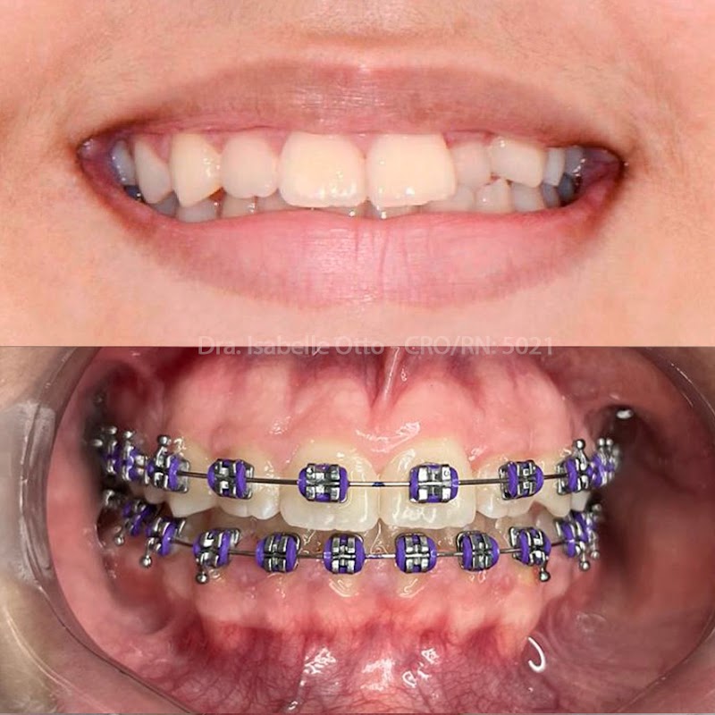 Odonto Vitta - Clínica Odontológica em Natal/RN - foto 3