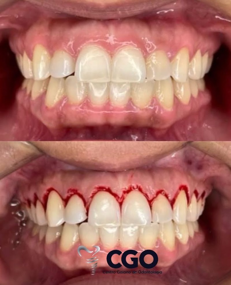 CGO - Centro Goiano de Odontologia - foto 3