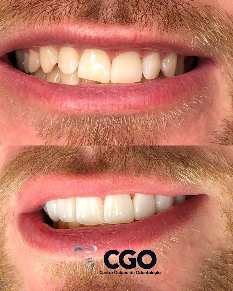 CGO - Centro Goiano de Odontologia - foto 2