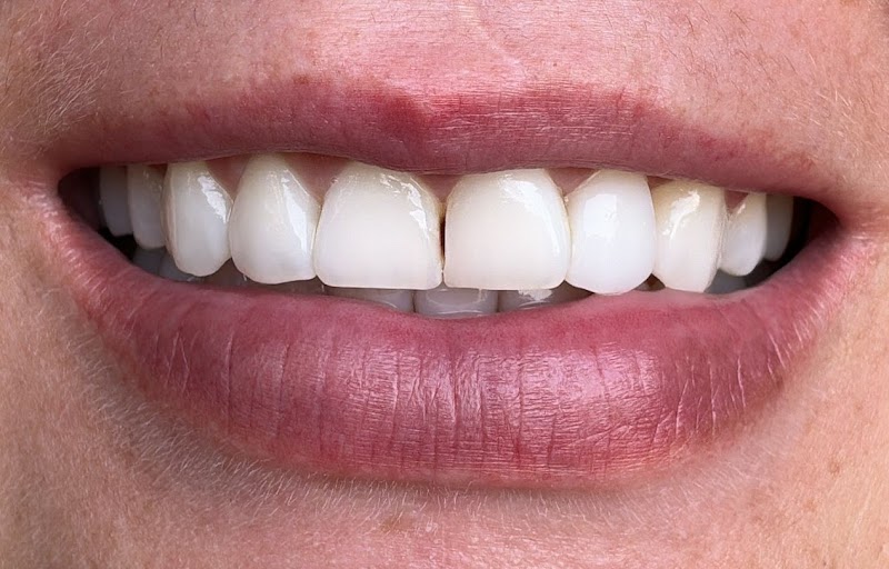 Dra. Larissa Bastos - LB Odontologia Especializada - foto 5