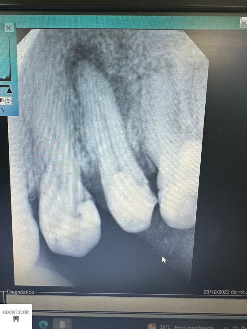 Clínica Odontológica Odontocor - Dentista Centro Rj | Especialista em Tratamento de Canal - foto 4