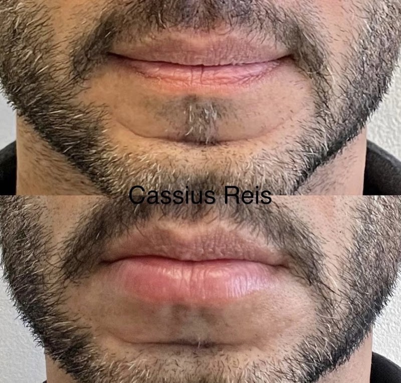 Dr. Cassius Reis - foto 5