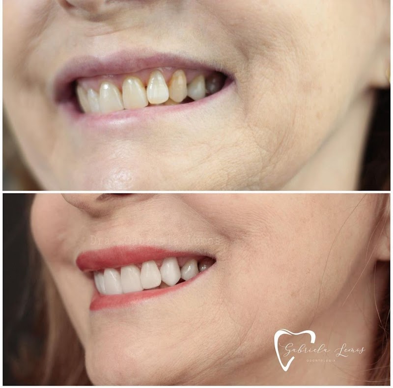 Dra. Gabriela Lemos, Dentista - foto 5