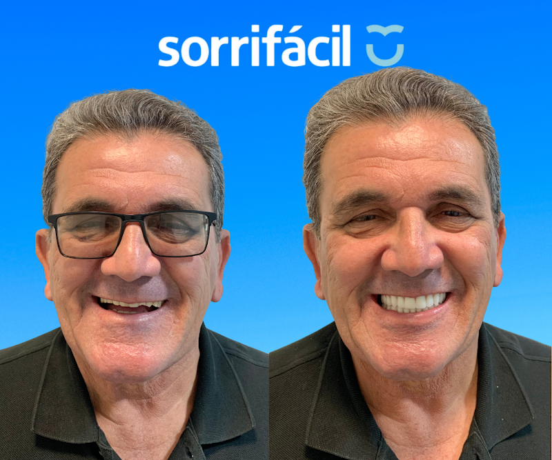 Sorrifácil Maceió | Implantes, Prótese Protocolo, Reabilitação Oral e Lentes de Contato - foto 1