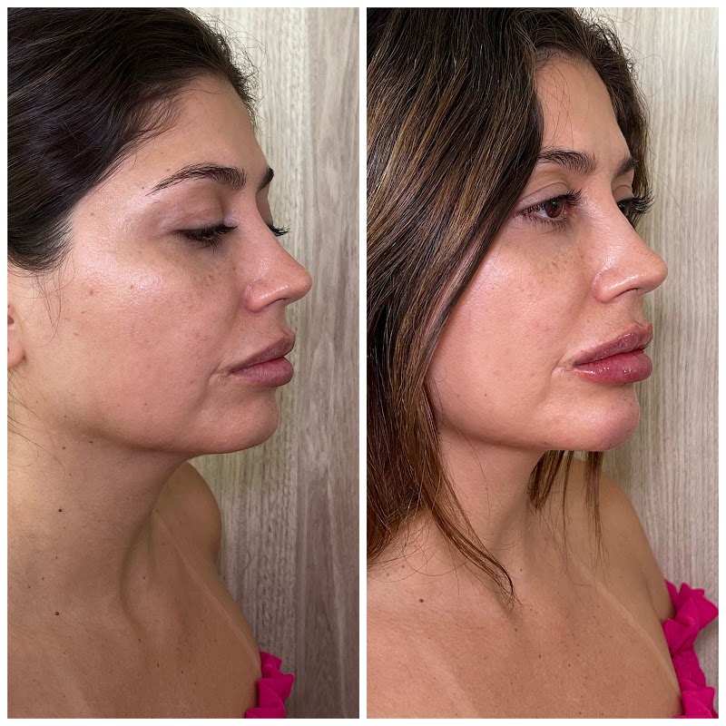 Dra. Natalia Colchete - foto 4