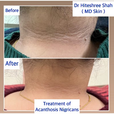 Shreemay Skin Clinic by Dr Hiteshree Shah|Best female skin Specialist |Acne specialist| Hair loss Expert |Laser Expert - Image 3