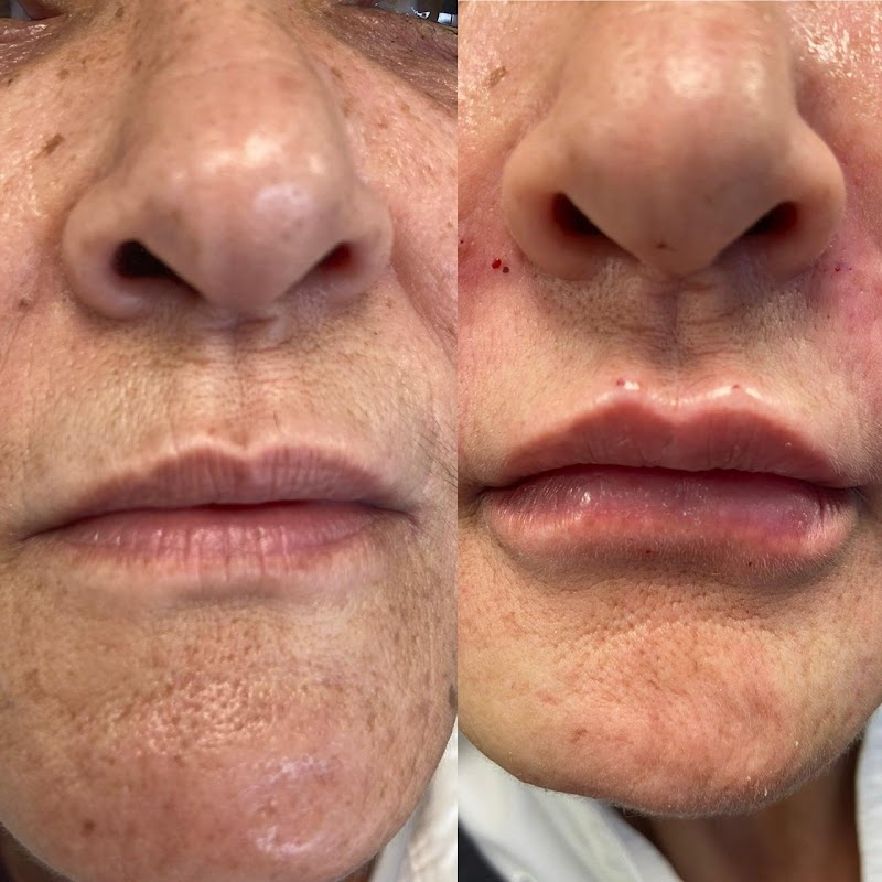 Dra Priscilla S. Ouverney Harmonização Facial - foto 5