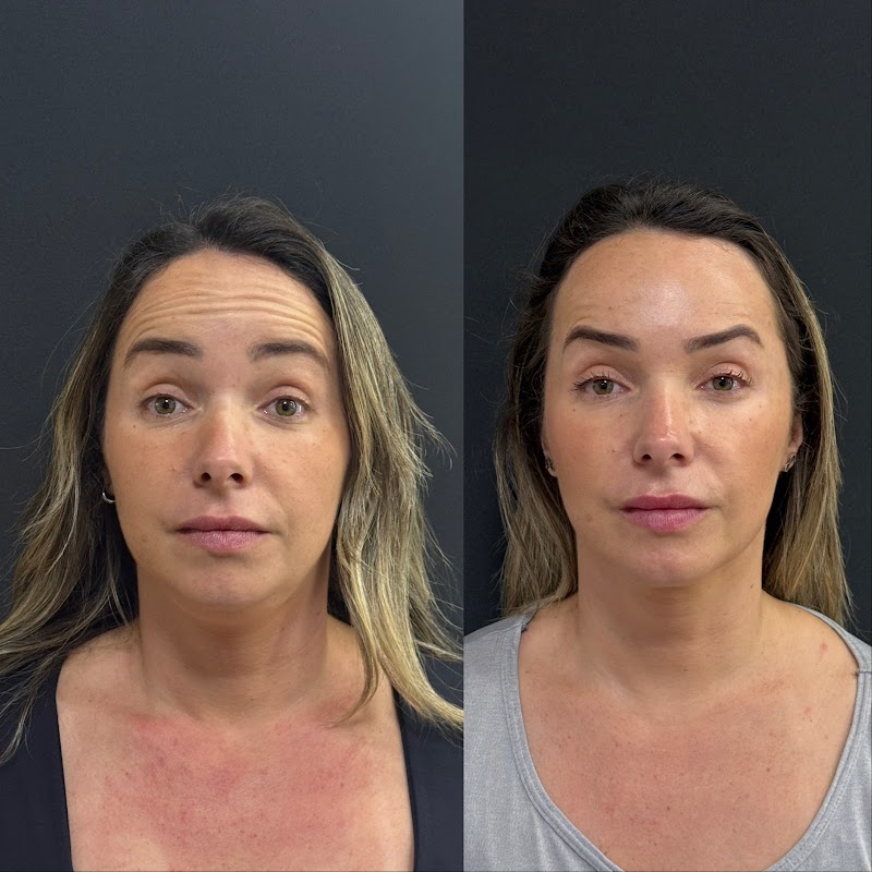 Dra Priscilla S. Ouverney Harmonização Facial