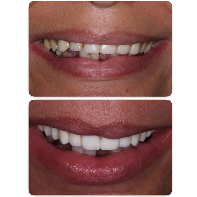 Dra. Marcela Fróes | Implantes dentários no Rio de Janeiro - foto 4