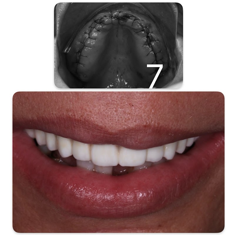 Dra. Marcela Fróes | Implantes dentários no Rio de Janeiro - foto 5