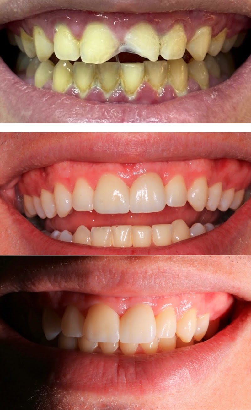 Dr. Leonardo Moll - Implantes Dentários e Reabilitação Oral