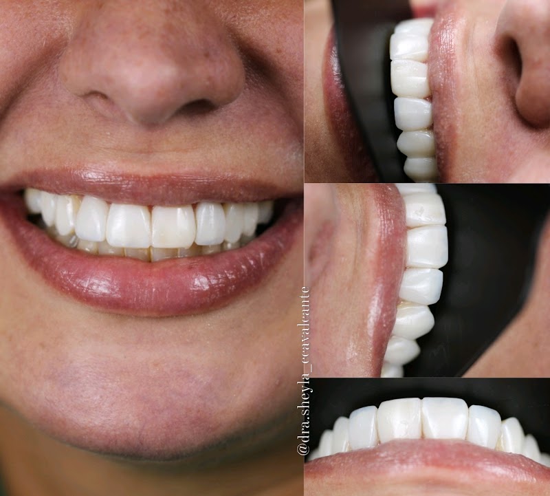 Dra Sheyla Cavalcante especialista em Implantodontia