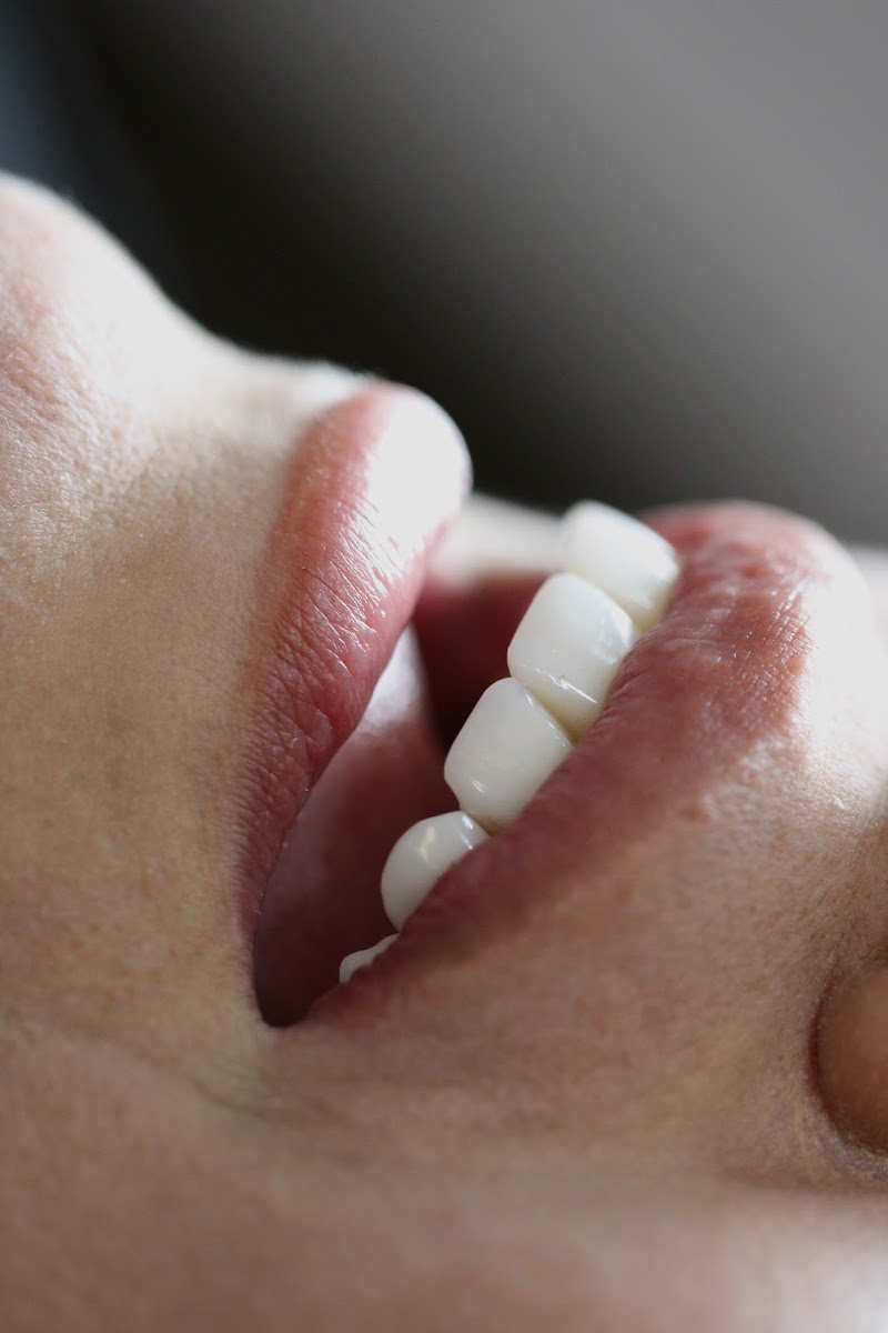 Dra Sheyla Cavalcante especialista em Implantodontia - foto 3