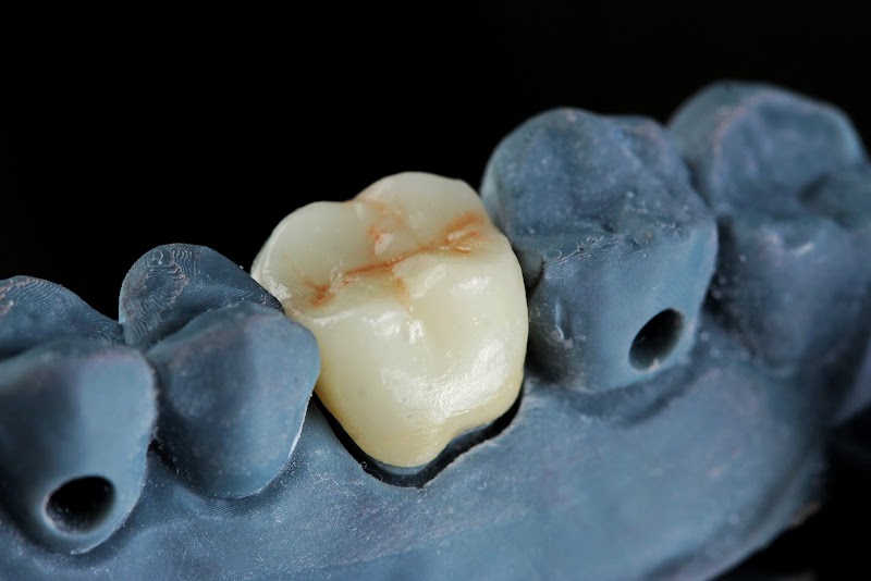 Dr. Ramon Luz - Implantodontia e Estética - foto 5