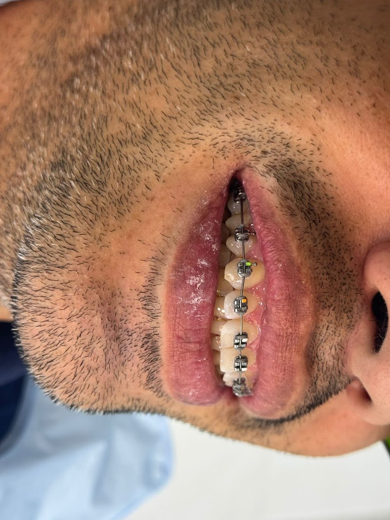 Dr Diego Dutra - NDClinic Macapá - Odonto e Harmonização Facial - foto 3