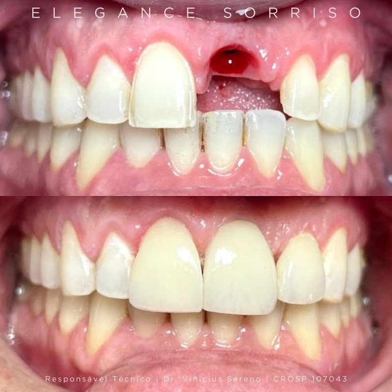 Elegance Sorriso | Dentista em Campinas - foto 2