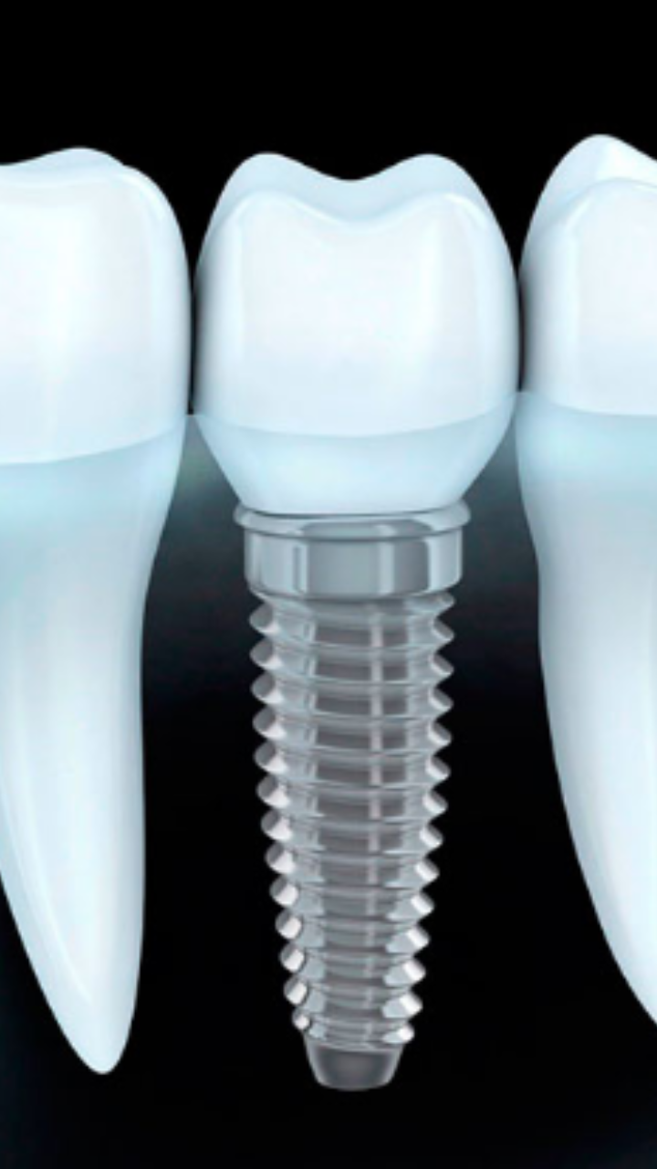 Dr aleixo neto implantes dentários - foto 4