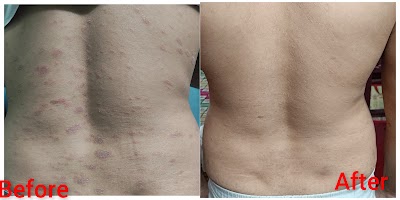 Dr. Shrestha Chakrabortty MD| Best Dermatologist in BARDHAMAN. Skin Doctor. - Image 3