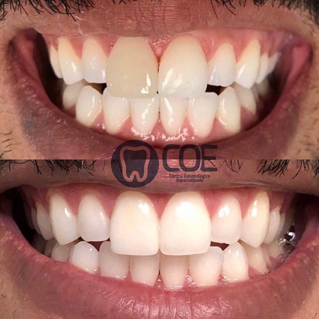 COE - Centro Odontológico Especializado | Dentista em Ceilândia - foto 4