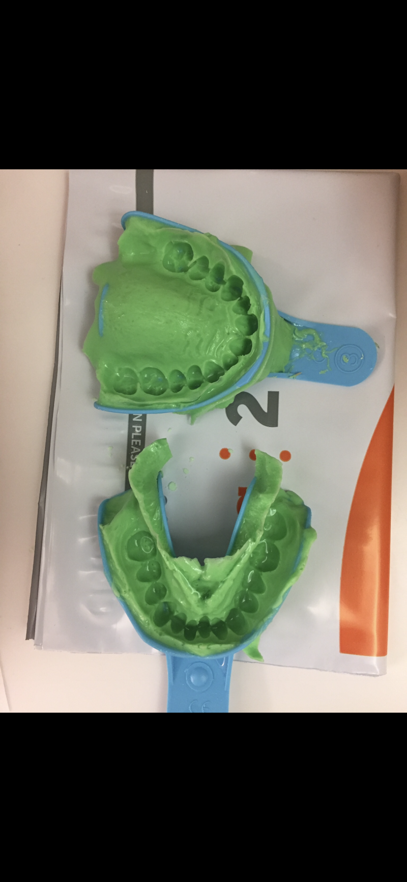 Docteur Bruno LELLOUCHE. Clinique du Mont-Louis. Chirurgie ORL.. Sommeil