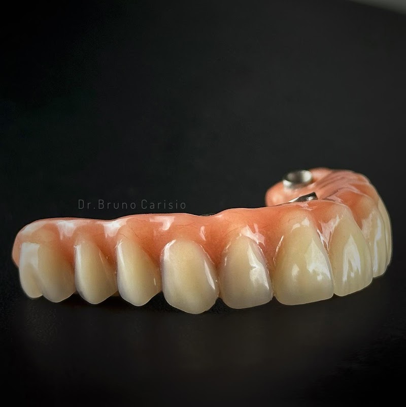 Dentista - Dr. Bruno Carisio - Lentes de Resina e Implantes - foto 2