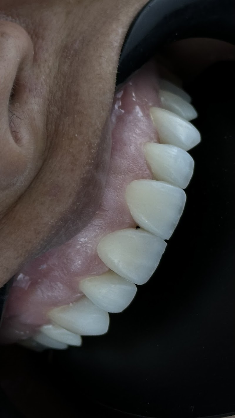 Dentista - Dr. Bruno Carisio - Lentes de Resina e Implantes - foto 5