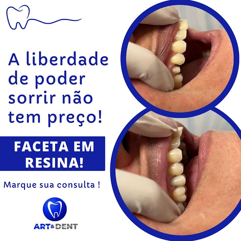 Art&Dent Tijuca 3 - Dentista com Preço Popular Rj, Dentista