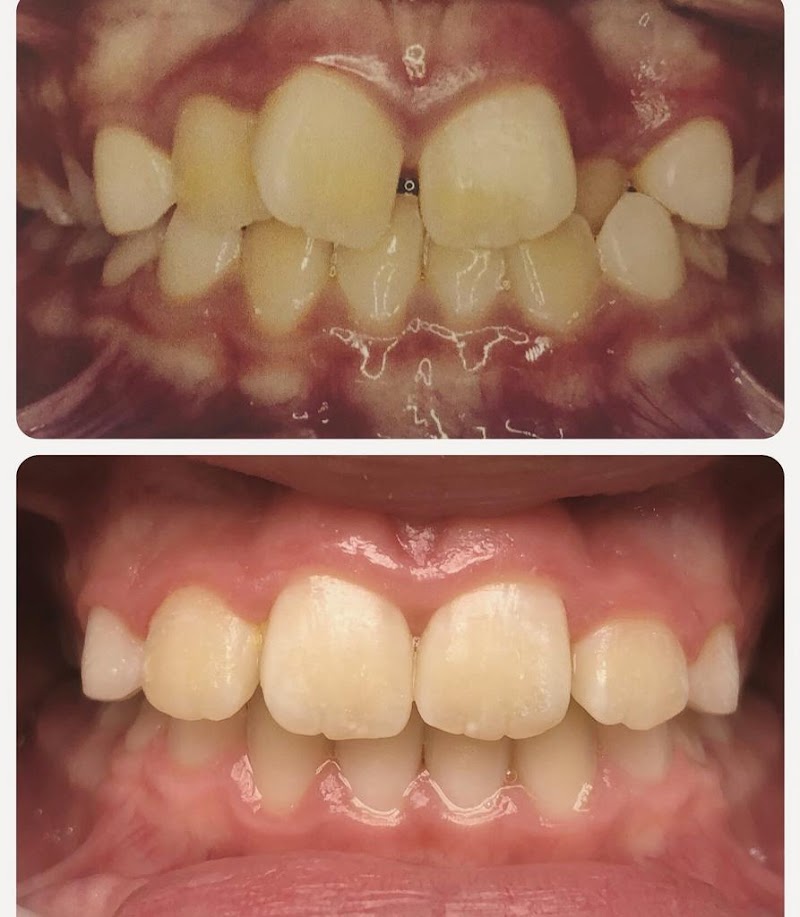 One Odontologia Moema - Invisalign em Moema - foto 3