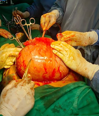 Dr. VAIBHAV SHARMA(M.S, D.N.B- Gynae) - Image 2