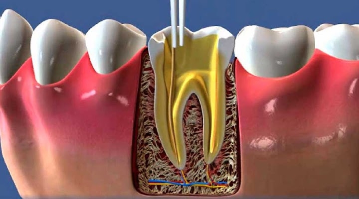 Dra. Ana Carvalho - Endodontia Avançada -Tijuca - foto 3