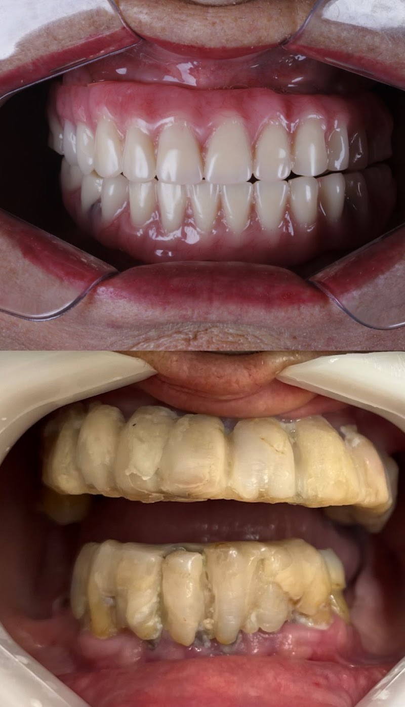 Estudiodonto Implante Dentário - Dentista Ribeirão preto - Campos Elísios Ribeirão Preto - foto 5