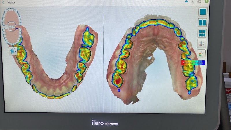 Dra Fernanda Lima - Endodontia (Tratamento de Canal) - foto 2