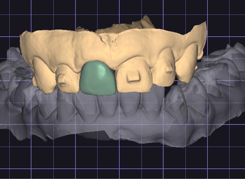 Dra Fernanda Lima - Endodontia (Tratamento de Canal) - foto 4