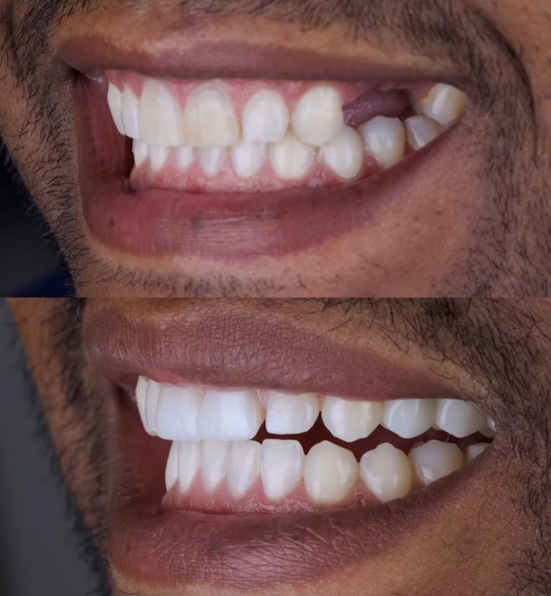 Dentista 24h | Elo Dent | Clínica Odontológica | Dentista em Goiânia GO | Implante Dentário - foto 3