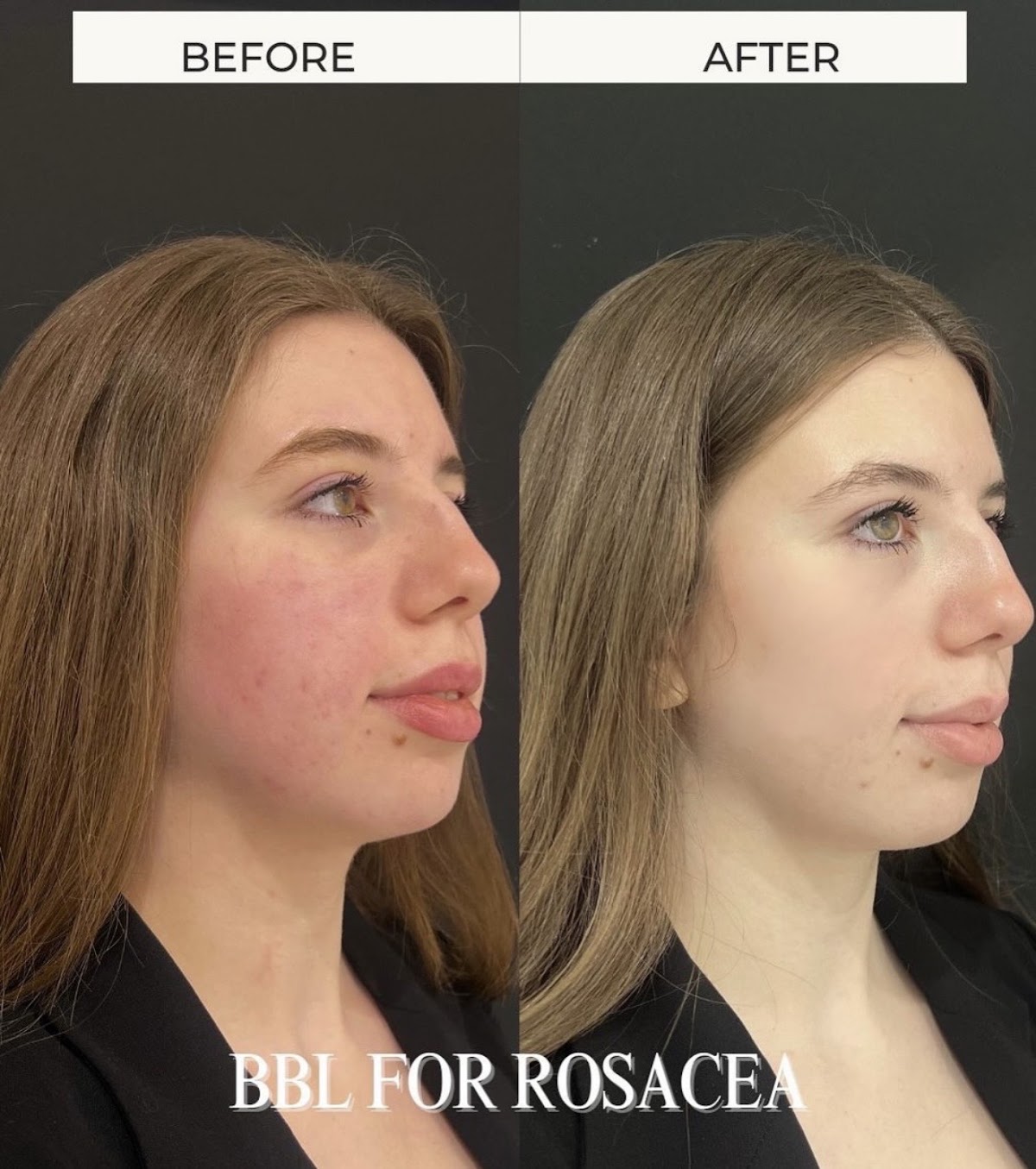 Anna Maria Nadolska – Cosmetologist & Laser Specialist 4