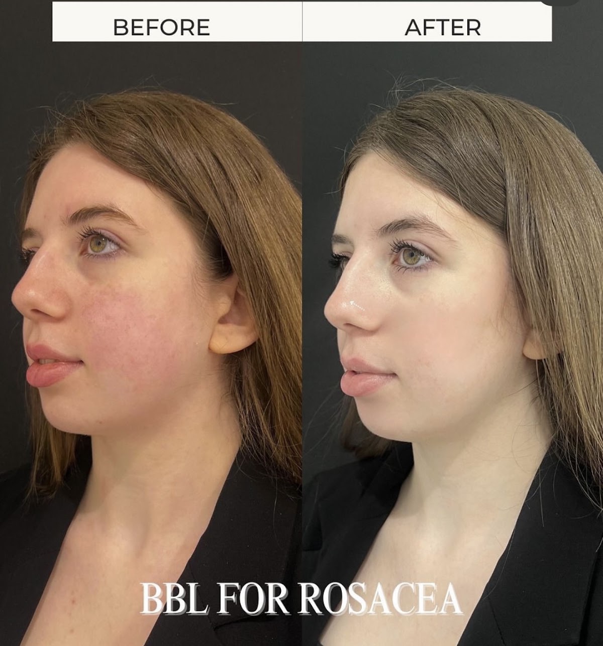 Anna Maria Nadolska – Cosmetologist & Laser Specialist 5