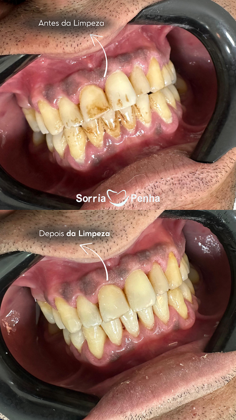 Clínica Sorria Penha - Unidade Caxias - foto 3