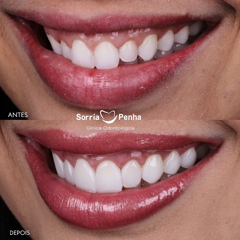 Clínica Sorria Penha - Unidade Caxias - foto 2