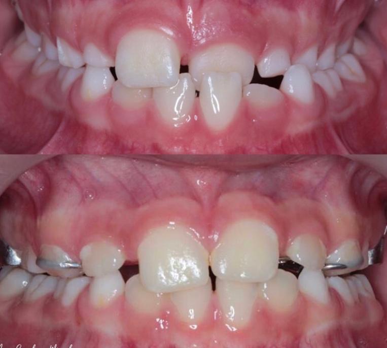 Dentista Dra. Ana Carolina Miguel - foto 2