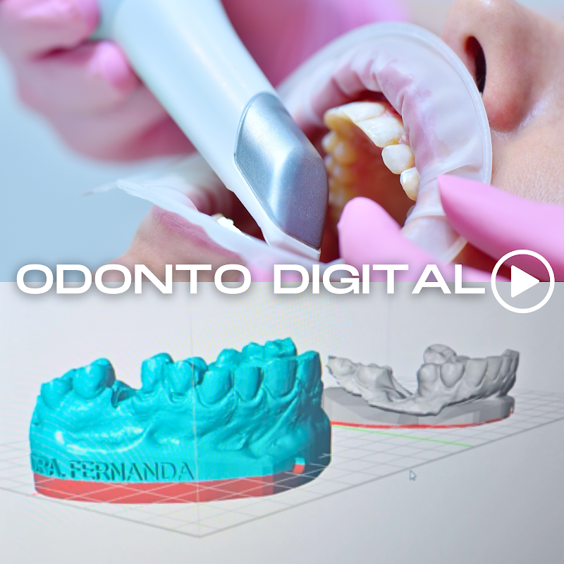 FACETAS EM RESINA E IMPLANTES DENTÁRIOS EM FLORIANÓPOLIS DRA. FERNANDA FERNANDES - foto 4