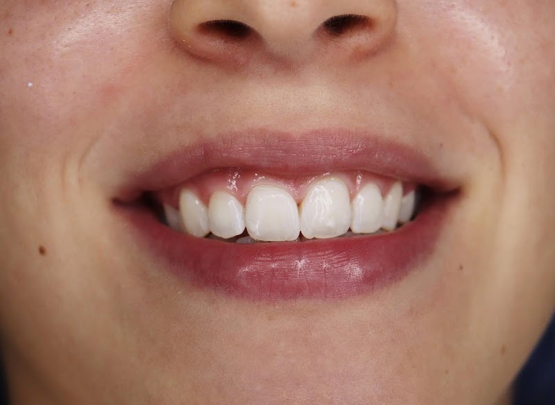 Clínica Teresa Longo - Ortodontia e Ortopedia Facial - Invisalign Doctor - foto 2