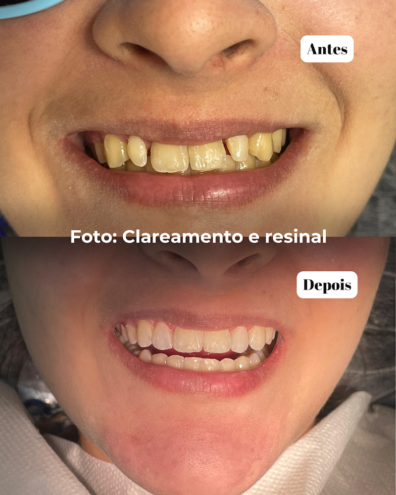 Clínica Teresa Longo - Ortodontia e Ortopedia Facial - Invisalign Doctor - foto 5