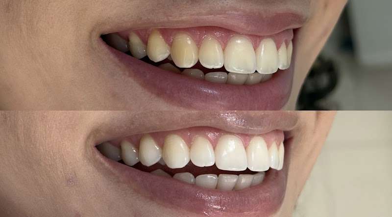 DRA. GABRIELLA SANTOS- TRATAMENTO DE CANAL | ENDODONTISTA CUIABÁ| CLAREAMENTO - foto 4