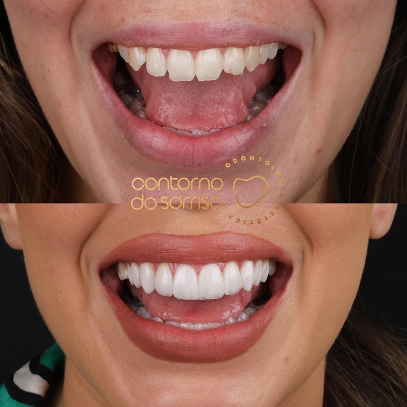 Contorno do Sorriso - foto 2