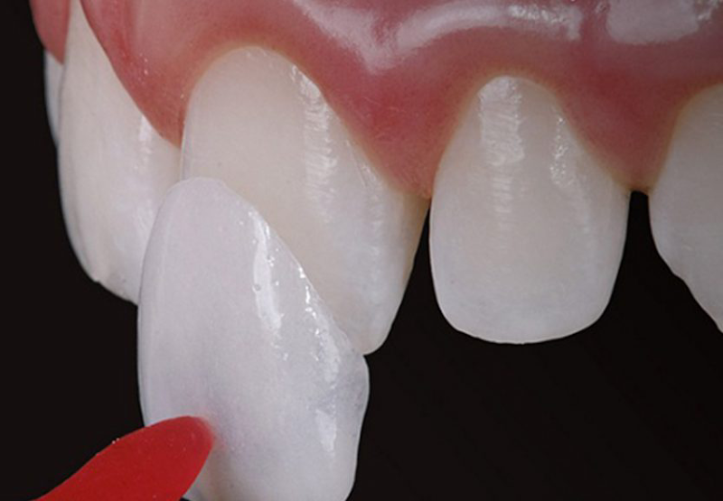 Só Sorriso Recreio - foto 3