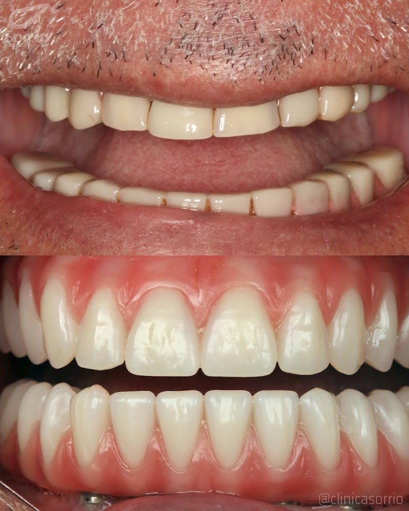 Clínica Sorrio | Implante Dentário | Dentista de emergência | Clínica odontológica | Copacabana | Rio de Janeiro - RJ - foto 4