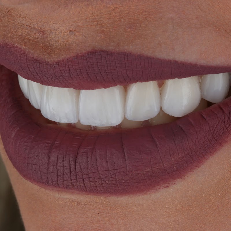 Clínica Sorrio | Implante Dentário | Dentista de emergência | Clínica odontológica | Copacabana | Rio de Janeiro - RJ - foto 5